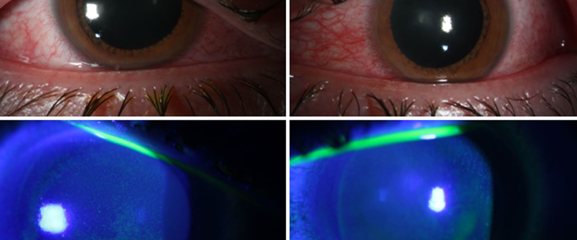 What is the Safe Exposure to UV Light? - An Expert's Perspective